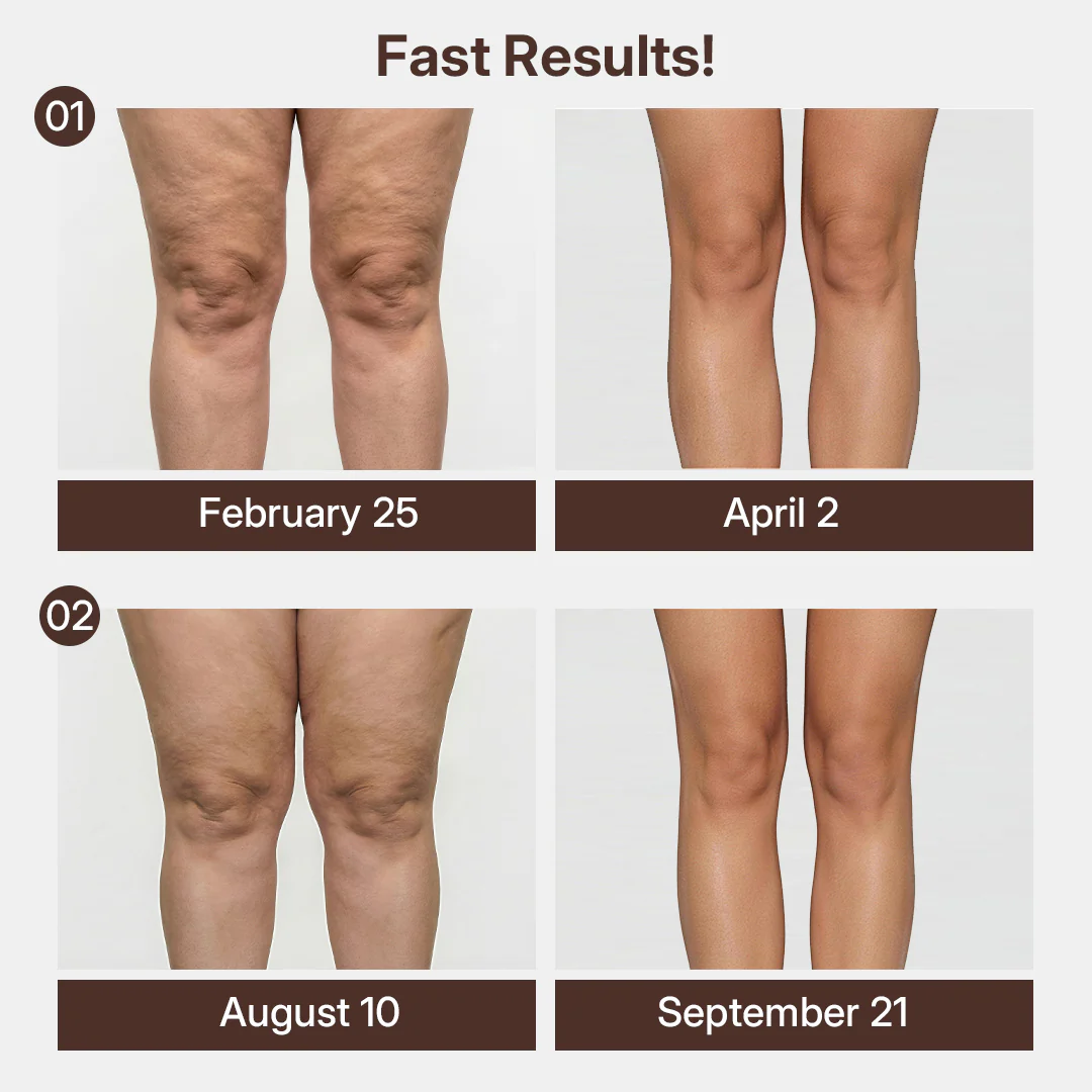 Silix™ 3D Compression Knee Sleeves –Say Goodbye to Saggy, Uneven-Looking Legs - Image 3